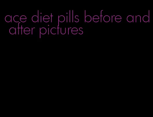 ace diet pills before and after pictures