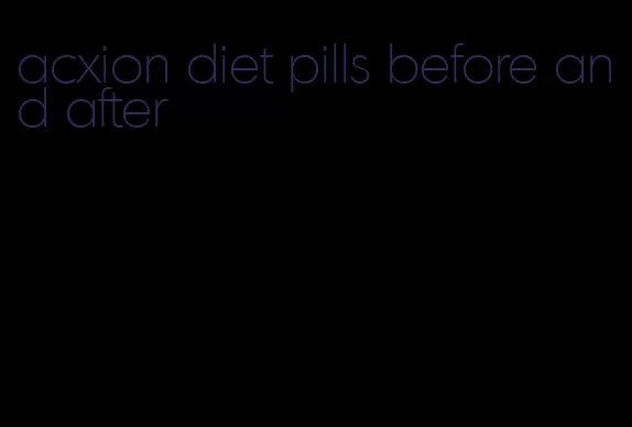acxion diet pills before and after