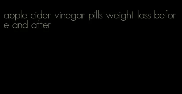 apple cider vinegar pills weight loss before and after