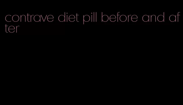 contrave diet pill before and after