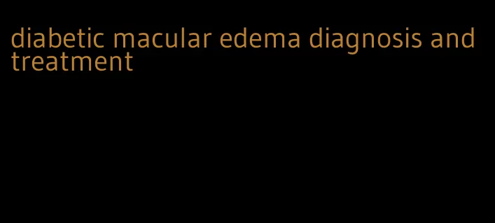diabetic macular edema diagnosis and treatment