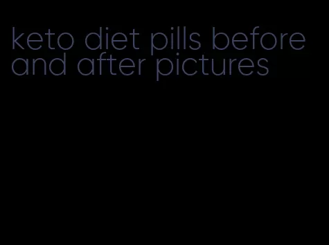 keto diet pills before and after pictures