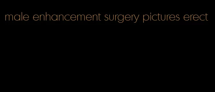 male enhancement surgery pictures erect