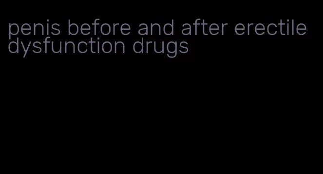 penis before and after erectile dysfunction drugs