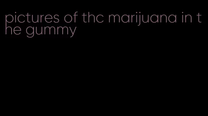 pictures of thc marijuana in the gummy