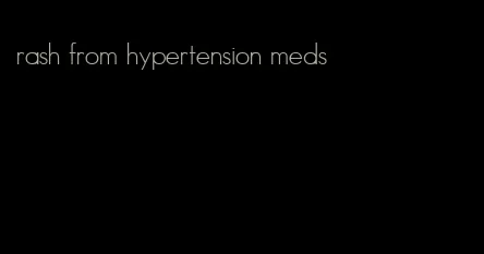 rash from hypertension meds