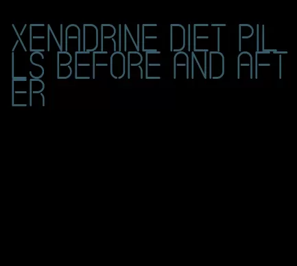 xenadrine diet pills before and after